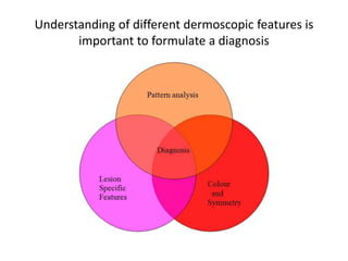 Understanding of different dermoscopic features is
important to formulate a diagnosis

 