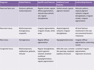 Diagnosis

Global Patterns

Specific Local Features Additional Local
Features

Confounding Features

Reed and Spitz nevi

Starburst, globular,
multicomponent

Regular streaks, regular Dotted vessels, typical
diffuse pigmentation,
pigment network
reticular blue-whitish
veil, regular
dots/globules

Reticular pattern;
atypical pigment
network, irregular
dots/globules, irregular
streaks, irregular
pigmentation

Recurrent nevus

Multicomponent,
homogeneous,
unspecific

Irregular pigmentation, Atypical pigment
irregular streaks, white network, irregular
areas
dots/globules

All local features
mentioned in this row
are commonly found in
melanoma

Blue nevus

Homogeneous

Regular diffuse
pigmentation

Hypopigmented areas

Irregular diffuse
pigmentation, arborizing
vessels

Congenital nevus

Multicomponent,
cobblestone, globular,
reticular

Regular dots/globules,
typical pigment
network, localized
multifocal
hypopigmentation,
regular pigmentation

Milia-like cysts, comedo- Localized irregular
like openings, exophytic pigmentation,
papillary structures
regression structures

 