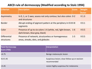 ABCD rule of dermoscopy (Modified according to Stolz 1994)
Criterion

Description

Score

Asymmetry

In 0, 1, or 2 axes; assess not only contour, but also colors 0-2
and structures

X 1.3

Border

Abrupt ending of pigment pattern at the periphery in 0-8 0-8
segments

X 0.1

Color

Presence of up to six colors 1-6 (white, red, light-brown, 1-6
dark-brown, blue-gray, black)

X 0.5

Differential
structures

Presence of network, structureless or homogeneous
areas, streaks, dots, and globules

X 0.5

1-5

Weight
factor

Total Dermoscopy
Score (TDS)

Interpretation

<4.75

Benign melanocytic lesion

4.8-5.45

Suspicious lesion; close follow-up or excision
recommended

>5.45

Lesion highly suspicious for melanoma

 
