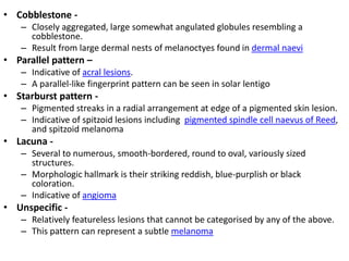 • Cobblestone – Closely aggregated, large somewhat angulated globules resembling a
cobblestone.
– Result from large dermal nests of melanoctyes found in dermal naevi

• Parallel pattern –
– Indicative of acral lesions.
– A parallel-like fingerprint pattern can be seen in solar lentigo

• Starburst pattern – Pigmented streaks in a radial arrangement at edge of a pigmented skin lesion.
– Indicative of spitzoid lesions including pigmented spindle cell naevus of Reed,
and spitzoid melanoma

• Lacuna – Several to numerous, smooth-bordered, round to oval, variously sized
structures.
– Morphologic hallmark is their striking reddish, blue-purplish or black
coloration.
– Indicative of angioma

• Unspecific – Relatively featureless lesions that cannot be categorised by any of the above.
– This pattern can represent a subtle melanoma

 