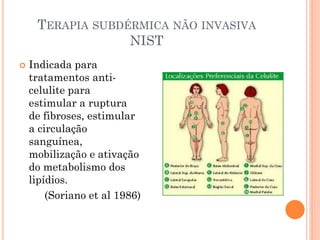 TERAPIA SUBDÉRMICA NÃO INVASIVA
NIST
 Indicada para
tratamentos anti-
celulite para
estimular a ruptura
de fibroses, estimular
a circulação
sanguínea,
mobilização e ativação
do metabolismo dos
lipídios.
(Soriano et al 1986)
 