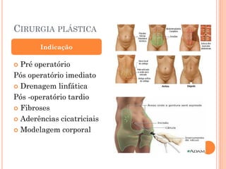 CIRURGIA PLÁSTICA
 Pré operatório
Pós operatório imediato
 Drenagem linfática
Pós -operatório tardio
 Fibroses
 Aderências cicatriciais
 Modelagem corporal
Indicação
 