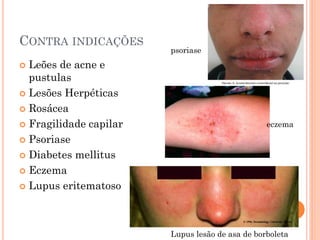 CONTRA INDICAÇÕES
 Leões de acne e
pustulas
 Lesões Herpéticas
 Rosácea
 Fragilidade capilar
 Psoriase
 Diabetes mellitus
 Eczema
 Lupus eritematoso
psoriase
eczema
Lupus lesão de asa de borboleta
 