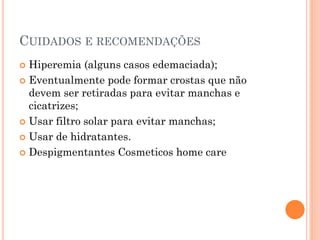CUIDADOS E RECOMENDAÇÕES
 Hiperemia (alguns casos edemaciada);
 Eventualmente pode formar crostas que não
devem ser retiradas para evitar manchas e
cicatrizes;
 Usar filtro solar para evitar manchas;
 Usar de hidratantes.
 Despigmentantes Cosmeticos home care
 