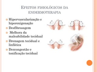 EFEITOS FISIOLÓGICOS DA
ENDERMOTERAPIA
 Hipervascularização e
hiperoxigenação
 Desfibrosagem
 Melhora da
maleabilidade tecidual
 Drenagem tecidual e
linfática
 Descongestão e
tonificação tecidual
 