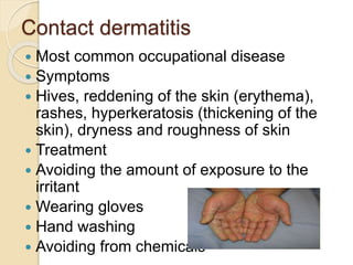 Contact dermatitis
 Most common occupational disease
 Symptoms
 Hives, reddening of the skin (erythema),
rashes, hyperkeratosis (thickening of the
skin), dryness and roughness of skin
 Treatment
 Avoiding the amount of exposure to the
irritant
 Wearing gloves
 Hand washing
 Avoiding from chemicals
 