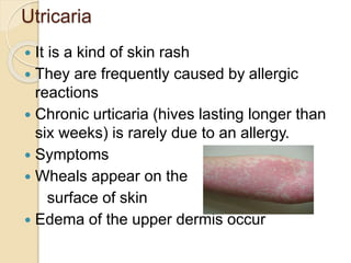 Utricaria
 It is a kind of skin rash
 They are frequently caused by allergic
reactions
 Chronic urticaria (hives lasting longer than
six weeks) is rarely due to an allergy.
 Symptoms
 Wheals appear on the
surface of skin
 Edema of the upper dermis occur
 