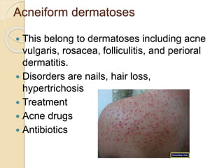 Acneiform dermatoses
 This belong to dermatoses including acne
vulgaris, rosacea, folliculitis, and perioral
dermatitis.
 Disorders are nails, hair loss,
hypertrichosis
 Treatment
 Acne drugs
 Antibiotics
 
