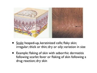 Derm slides | KEY
