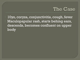 


10yo, coryza, conjunctivitis, cough, fever
Maculopapular rash, starts behing ears,
descends, becomes confluent on upper
body

 