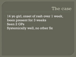 



14 yo girl, onset of rash over 1 week,
been present for 3 weeks
Seen 2 GPs
Systemically well, no other Sx

 