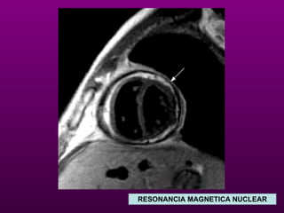 RESONANCIA MAGNETICA NUCLEAR 