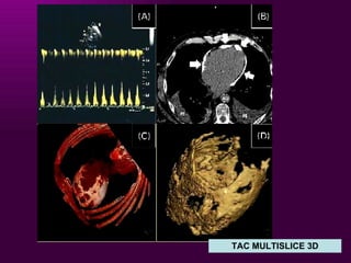 TAC MULTISLICE 3D 