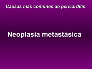 Neoplasia metastásica Causas más comunes de pericarditis 
