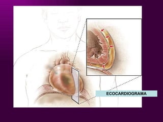 ECOCARDIOGRAMA 