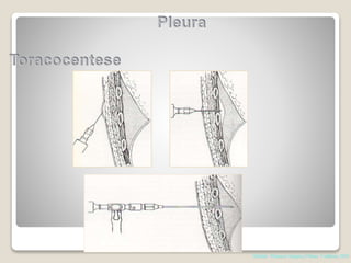 Shields. Thoracic Surgery,Clinics 7 edition; 2015
 