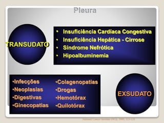 • Insuficiência Cardíaca Congestiva
• Insuficiência Hepática - Cirrose
• Síndrome Nefrótica
• Hipoalbuminemia
TRANSUDATO
•Infecções
•Neoplasias
•Digestivas
•Ginecopatias
•Colagenopatias
•Drogas
•Hemotórax
•Quilotórax
EXSUDATO
National Cancer Institute (NCI), 2008; 123-128
 