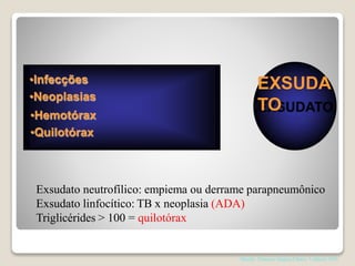 •Infecções
•Neoplasias
•Hemotórax
•Quilotórax
EXSUDA
TO
Exsudato neutrofílico: empiema ou derrame parapneumônico
Exsudato linfocítico: TB x neoplasia (ADA)
Triglicérides > 100 = quilotórax
Shields. Thoracic Surgery,Clinics 7 edition; 2015
 