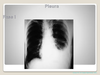 Abrao FC, H. Santa Marcelina, 2011
 