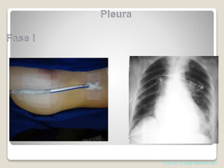 Abrao FC, H. Santa Marcelina, 2011
 
