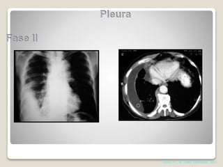 Abrao FC, H. Santa Marcelina, 2011
 