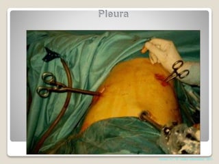 Abrao FC, H. Santa Marcelina, 2011
 