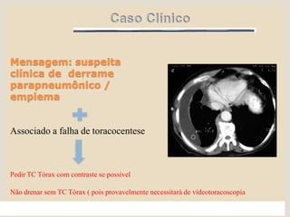 Mensagem: suspeita
clínica de derrame
parapneumônico /
empiema
Associado a falha de toracocentese
Pedir TC Tórax com contraste se possível
Não drenar sem TC Tórax ( pois provavelmente necessitará de videotoracoscopia
 