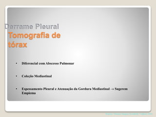 Tomografia de
tórax
• Diferencial comAbscesso Pulmonar
• Coleção Mediastinal
• Espessamento Pleural e Atenuação da Gordura Mediastinal  Sugerem
Empiema
Pearson. Thoracic Surgery,Texxtbokk 7 edition; 2014
 