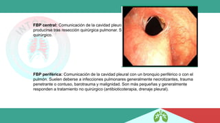 FBP central: Comunicación de la cavidad pleural con un bronquio central. Suelen
producirse tras resección quirúrgica pulmonar. Suelen ser grandes y requerir tratamiento
quirúrgico.
FBP periférica: Comunicación de la cavidad pleural con un bronquio periférico o con el
pulmón. Suelen deberse a infecciones pulmonares generalmente necrotizantes, trauma
penetrante o contuso, barotrauma y malignidad. Son más pequeñas y generalmente
responden a tratamiento no quirúrgico (antibioticoterapia, drenaje pleural).
 