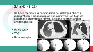 DIAGNOSTICO
• Se hace mediante la combinación de hallazgos clínicos,
radiográficos y broncoscopios que confirman una fuga de
aire desde un bronquio mayor, lobular o segmentario al
espacio pleural
• Rx de tórax
• TAC
• Broncoscopia
 