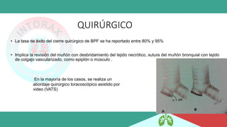 QUIRÚRGICO
• La tasa de éxito del cierre quirúrgico de BPF se ha reportado entre 80% y 95%
• Implica la revisión del muñón con desbridamiento del tejido necrótico, sutura del muñón bronquial con tejido
de colgajo vascularizado, como epiplón o músculo .
En la mayoría de los casos, se realiza un
abordaje quirúrgico toracoscópico asistido por
video (VATS)
 