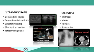 ULTRASONOGRAFIA
• Densidad del liquido
• Determinar si es tabicado
• Características Liq
• Marcar sitio punción
• Toracentesis guiada
TAC TORAX
• Infiltrados
• Masas
• Nódulos
• Atelectasias
 