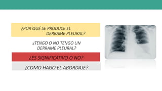 ¿POR QUÉ SE PRODUCE EL
DERRAME PLEURAL?
¿TENGO O NO TENGO UN
DERRAME PLEURAL?
¿ES SIGNIFICATIVO O NO?
¿COMO HAGO EL ABORDAJE?
 