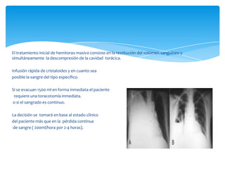 El tratamiento inicial de hemitorax masivo consiste en la restitución del volúmen sanguíneo y
simultáneamente la descompresión de la cavidad torácica.
Infusión rápida de cristaloides y en cuanto sea
posible la sangre del tipo específico.
Si se evacuan 1500 ml en forma inmediata el paciente
requiere una toracotomía inmediata.
o si el sangrado es continuo.
La decisión se tomará en base al estado clínico
del paciente más que en la pérdida contínua
de sangre ( 200ml/hora por 2-4 horas).
 