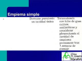 Empiema simple 