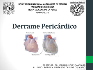 Derrame Pericárdico
UNIVERSIDAD NACIONAL AUTONOMA DE MEXICO
FACULTAD DE MEDICINA
HOSPITAL GENERAL LA PERLA
GRUPO 3735
PROFESOR: DR. IGNACIO ROJAS SANTIAGO
ALUMNO: POPOCA PLUTARCO CARLOS ORLANDO
 