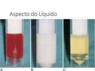 Aspecto do Líquido
 