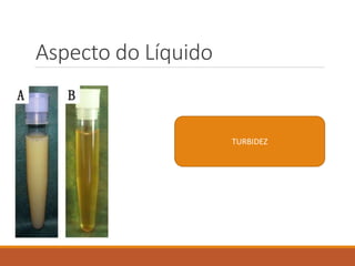 Aspecto do Líquido
TURBIDEZ
 