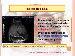 ECOGRAFÍA El mayor avance respecto a la radiografía es la capacidad de diferenciar elementos  sólidos de líquidos Diferencia anormalidades  subfrénicas y subpulmonares Toracocentesis guiada No es práctico recomendar la ecografía para todos los derrames Yataco JC, Cleveland clinic journal medicine, 2005 