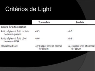 Critérios de Light
 