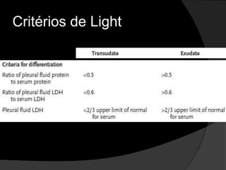 Diferenciação entre Exsudato e TransudatoExsudatos: Ocorrem quando os fatores locais que influenciam o acúmulo de líquido pleural são alterados. As principais causas são: pneumonia, câncer, e embolia pulmonar.Light, RW. ArchInternMed 1973;132:854-60.