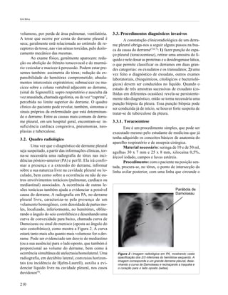 GA Silva




volumoso, por perda de área pulmonar, ventilatória.        3.3. Procedimentos diagnósticos invasivos
A tosse que ocorre por conta do derrame pleural é                 A constatação clinicoradiológica de um derra-
seca; geralmente está relacionada ao estímulo de re-       me pleural obriga-nos a seguir alguns passos na bus-
ceptores da tosse, nas vias aéreas torcidas, pelo deslo-   ca da causa do derrame(5,6,7): 1) fazer punção do espa-
camento mecânico das mesmas.                               ço pleural (toracocentese), retirar uma amostra do lí-
       Ao exame fïsico, geralmente aparecem: redu-         quido e nele dosar as proteínas e a desidrogenase lática,
ção ou abolição do frêmito toracovocal e do murmú-         o que permite classificar os derrames em duas gran-
rio vesicular e macicez à percussão. Podem estar pre-      des categorias: os exsudatos e os transudatos; 2) uma
sentes também: assimetria do tórax; redução da ex-         vez feito o diagnóstico de exsudato, outros exames
pansibilidade do hemitórax comprometido; abaula-           laboratoriais, (bioquímicos, citológicos e bacterioló-
mentos intercostais expiratórios; submacicez ou ma-        gicos) devem ser conduzidos no líquido. Quando o
cicez sobre a coluna vertebral adjacente ao derrame,       estudo de três amostras sucessivas de exsudato (co-
(sinal de Signorelli); sopro respiratório e ausculta da    lhidas em diferentes ocasiões) revela-se persistente-
voz anasalada, chamada egofonia, ou da voz “caprina”,      mente não diagnóstico, então se torna necessária uma
percebida no limite superior do derrame. O quadro          punção biópsia da pleura. Essa punção biópsia pode
clínico do paciente pode revelar, também, sintomas e       ser conduzida já de início, se houver forte suspeita de
sinais próprios da enfermidade que está determinan-        tratar-se de tuberculose da pleura.
do o derrame. Entre as causas mais comuns de derra-
me pleural, em um hospital geral, encontram-se: in-        3.3.1. Toracocentese
suficiência cardíaca congestiva, pneumonias, neo-                 Este é um procedimento simples, que pode ser
plasias e tuberculose.                                     executado mesmo pelo estudante de medicina que já
3.2. Quadro radiológico                                    tenha adquirido os conceitos básicos de anatomia do
                                                           aparelho respiratório e de assepsia cirúrgica.
       Uma vez que o diagnóstico de derrame pleural               Material necessário: seringa de 10 e de 50 ml,
seja suspeitado, a partir das informações clínicas, tor-   agulhas 30 x 7 mm e 25 x 8 mm, xilocaína 0,5%,
na-se necessária uma radiografia de tórax nas inci-        álcool iodado, campos e luvas estéreis.
dências póstero-anterior (PA) e perfil. Ela irá confir-           Procedimento: com o paciente na posição sen-
mar a presença e a extensão do derrame, informar           tada, procura-se, no tórax, o ponto de intersecção da
sobre a sua natureza livre na cavidade pleural ou lo-      linha axilar posterior, com uma linha que circunde o
culado, bem como sobre a ocorrência ou não de ou-
tros envolvimentos torácicos (pulmonar, cardíaco ou
mediastinal) associados. A ocorrência de outras le-
sões torácicas também ajuda a evidenciar a possível                                                     Parábola de
causa do derrame. A radiografia em PA, no derrame                                                       Damoiseau
pleural livre, caracteriza-se pela presença de um
velamento homogêneo, com densidade de partes mo-
les, localizado, inferiormente, no hemitórax, oblite-
rando o ângulo do seio costofrênico e desenhando uma
curva de convexidade para baixo, chamada curva de
Damoiseau ou sinal do menisco (oposta ao ângulo do
seio costofrênico), como mostra a Figura 2. A curva
estará tanto mais alta quanto mais volumoso for o der-
rame. Pode ser evidenciado um desvio do mediastino
(ou a sua ausência) para o lado oposto, que também é
proporcional ao volume do derrame, bem como à
ocorrência simultânea de atelectasia homolateral. Uma         Figura 2 - Imagem radiológica em PA, mostrando vasta
radiografia, em decúbito lateral, com raios horizon-          opacificação dos 2/3 inferiores do hemitórax esquerdo. A
                                                              imagem corresponde a um grande derrame pleural, dese-
tais (ou incidência de Hjelm-Laurell), auxilia a evi-         nhando a curva de Damoiseau e rechaçando a traquéia e
denciar líquido livre na cavidade pleural, nos casos          o coração para o lado oposto (setas).
duvidosos(4).

210
 