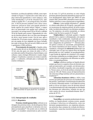 Derrames pleurais: fisiopatologia e diagnóstico




hemitórax, na altura do apêndice xifóide, como repre-           cia de mais 2,5 g/dl de proteínas ou uma relação
sentado na Figura 3. O ponto deve estar sobre um es-            proteínas pleurais/proteínas plasmáticas maior que 0,5
paço intercostal (geralmente o sexto espaço) e, nele,           e/ou desidrogenase lática maior que 200UI ou uma
serão introduzidos 5 a 8 ml de xilocaína 0,5%, utili-           relação DHL pleural/DHL plasmática maior que 0,6.
zando-se agulha 30 x 7, em seringa de dez (10) milili-          Valores inferiores a esses caracterizam os transudatos.
tros. A fim de prevenir acidentes com o feixe vascu-                   Glicose: é uma medida informativa (9), quando
lonervoso, procura-se fazer essa punção próximo à               os valores estão abaixo de 50 mg/dl, o que pode ocor-
borda superior da costela inferior. Depois, o espaço            rer na presença de empiema pleural, de artrite reuma-
deve ser puncionado com agulha mais calibrosa, se               tóide, na tuberculose pleural e nos derrames neoplási-
necessário, em seringa maior (20 ou 50 ml) e colhidos           cos. No empiema e na artrite reumatóide, os valores
50 ml de líquido para exames. Dependendo do volu-               podem estar tão baixos quanto 0-10 mg/dl.
me do derrame pleural, deve ser feita uma drenagem                     Triglicerídeos: é solicitado quando o líquido
de alívio, nesse mesmo evento. Em tal caso, após a              pleural é turvo, espesso e esbranquiçado, com aspecto
retirada dos 50 ml para exame, substitui-se a seringa           semelhante a leite condensado, visualizado por oca-
por um equipo de soro adaptado em frasco fechado,               sião da punção. Valores acima de 110 mg/dl caracteri-
por onde se deixam fluir até um mil (1000) ou um mil            zam o diagnóstico de quilotórax(10,11). Derrame pleu-
e quinhentos (1500) mililitros.                                 ral quiloso costuma ser encontrado, principalmente,
       Processamento do material: o líquido coleta-             nas roturas traumáticas do ducto torácico. Nessa cir-
do para exame deverá ser distribuído em alíquotas de            cunstância, a dosagem de colesterol também deve ser
10 ml, uma das quais em citrato de sódio a 3,8% e               solicitada, uma vez que esse aspecto físico do líquido
enviadas para análise bioquímica, bacteriológica, com           pleural pode ser visto, também, no pseudoquilotórax,
culturas, e para citologia diferencial e exame citopa-          o qual resulta do depósito de colesterol e de comple-
tológico. Usualmente, a amostra em citrato é centrifu-          xos lecitina e globulina na cavidade pleural. As impli-
gada, e o sedimento, utilizado para a realização dos            cações clínicas e terapêuticas são diferentes no quilo-
exames citológicos.                                             tórax e no pseudoquilitórax.
                                                                       Amilase: solicita-se amilase no líquido pleural,
                                                                sempre que houver a suspeita clínica de derrame cau-
                                                                sado por pancreatite, por exemplo, um derrame pleu-
       Linha axilar                                             ral crônico, localizado à esquerda, sem causa aparen-
       posterior                                                te. Nesses casos, os níveis de amilase costumam estar
                                                                acima de 150 u/dl. Outras causas de hiperamilasemia
                                                                são rotura de esôfago (amilase salivar), pneumonias e
    Ponto habitual de
                                                   Linha        neoplasias(12).
                                                   xifoidiana          Adenosina deaminase (ADA): a ADA é uma
     toracocentese
                                                                enzima que participa dos processos de metabolização
                                                                das purinas, catalisando a transformação da adenosina
                                                                em inosina e liberando amônia. A atividade da enzima
                                                                pode se elevar em alguns casos de derrame pleural
   Figura 3 - Representação do local geralmente escolhido
                                                                e sua determinação tem sido empregada na elucidação
   para toracocentese de líquido pleural livre, na cavidade.    dos derrames por tuberculose, situação em que seu
                                                                valor estaria em níveis inconfundivelmente altos(4),
                                                                acima de 45 U/L.
                                                                3.3.2.2. Citologia(13)
3.3.2. Interpretação do resultados
                                                                       Neutrófilos: um aumento predominante de neu-
3.3.2.1. Bioquímica                                             trófilos, no líquido pleural, costuma ocorrer, quando
       Proteína e desidrogenase lática: utilizam-se as          a etiologia é infecciosa ou inflamatória, como nos
dosagens das proteínas totais e da desidrogenase lática         derrames parapneumônicos, nos empiemas pleurais,
principalmente para classificar os derrames em exsu-            nas primeiras duas semanas de evolução da tubercu-
datos ou transudatos(8). De acordo com os critérios de          lose pleural e numa fase inicial do derrame por artrite
Light(8), os exsudatos caracterizam-se pela ocorrên-            reumatóide.

                                                                                                                                  211
 