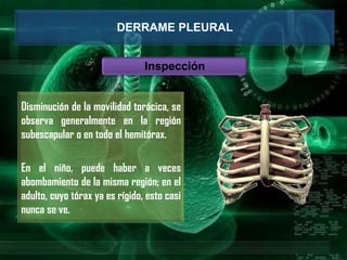 DERRAME PLEURAL
Inspección
Disminución de la movilidad torácica, se
observa generalmente en la región
subescapular o en todo el hemitórax.
En el niño, puede haber a veces
abombamiento de la misma región; en el
adulto, cuyo tórax ya es rígido, esto casi
nunca se ve.
 
