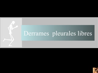 Derrames pleurales libres
 
