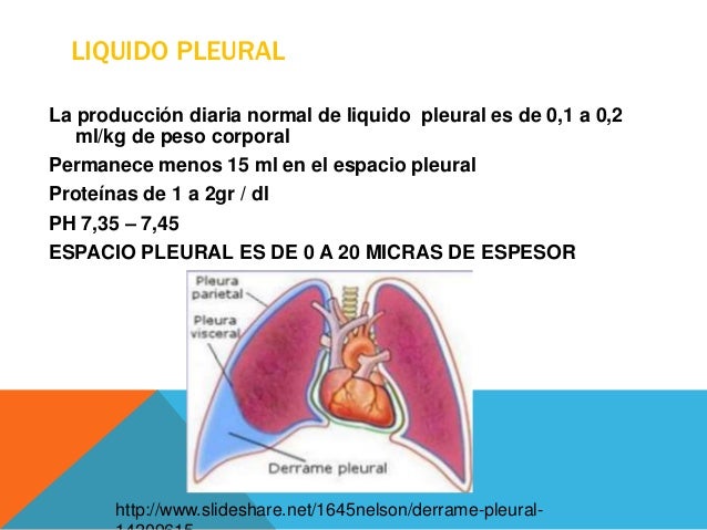 Derrame pleural