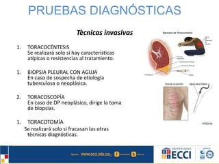 PRUEBAS DIAGNÓSTICAS 
1. TORACOCÉNTESIS 
Tècnicas invasivas 
Se realizará solo si hay características 
atípicas o resistencias al tratamiento. 
1. BIOPSIA PLEURAL CON AGUJA 
En caso de sospecha de etiología 
tuberculosa o neoplásica. 
2. TORACOSCOPÍA 
En caso de DP neoplásico, dirige la toma 
de biopsias. 
1. TORACOTOMÍA 
Se realizará solo si fracasan las otras 
tècnicas diagnósticas. 
 