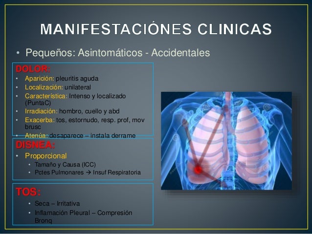 Como Se Ausculta Un Derrame Pleural