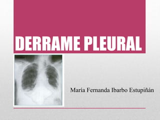 DERRAME PLEURAL
María Fernanda Ibarbo Estupiñán
 