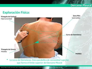 derramepleural-160511031754............. | PPTX